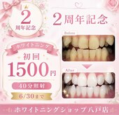 ホワイトニングショップ 八戸店