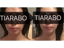 ティアラボ(TIARABO)/