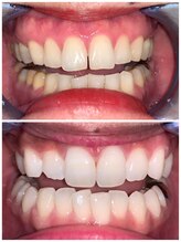 ライトビューティー 池袋店(LightBeauty)/症例写真