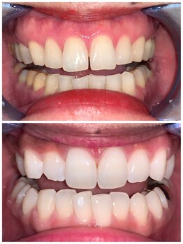 ライトビューティー 池袋店(LightBeauty)/症例写真