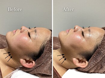 エリー(Ellie)/結婚式前直前1回プラン♪