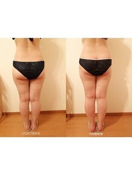 アンジュ/【美脚&美尻】コース