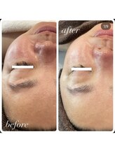 ラディエンス 多治見店/リアボーテマーメイドセルエステ