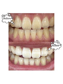 エクシアホワイトニング 東上野店/エクシアホワイトニング東上野店