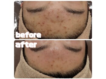 エステティック レイビス 川崎店(RAYVIS)/