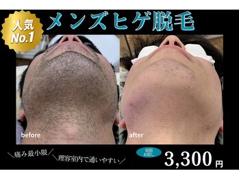 ラウラボ バイ ウォーヴォ(RAW LAB by UOVO)の写真/通いやすいメンズ専門店でヒゲ脱毛♪鎮静ハイドロジェリーマスクで整う◎