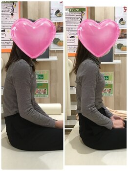 くすの樹接骨院 整体院 吉野ヶ里院/整体/骨盤矯正ビフォーアフター