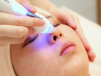 ソイススタジオ(SO-ISU STUDIO)の写真/【水素で毛穴にダイレクトアプローチ+顔脱毛★初回¥7000】水素ジェットで肌活性し毛穴洗浄+脱毛でつるつる!