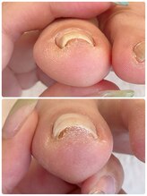 寺子屋ビューティーズ(寺子屋Beauty's)/1回でこの変化！