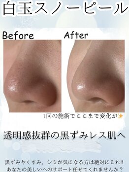 ローマサロン/毛穴レスな小鼻に