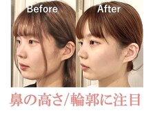 隆鼻矯正専門店 ラプリセレネ (Raplit Selene)