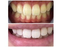 夏目ホワイトニングアンドネイル(夏目WHITENING＆NAIL)