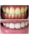 夏目ホワイトニングアンドネイル(夏目WHITENING＆NAIL)の写真/結果重視◎輝くような白い歯に！短時間、リーズナブルにホワイトニング体験しませんか？