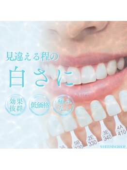 ホワイトニングショップ 元町 中華街店/効果に自信あり!ホワイトニング