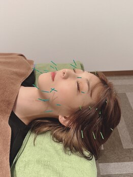 くるみ堂 祖師谷大蔵院/美容鍼