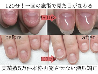 ティアラネイル(tiaranail)の写真