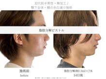 サボラミ(sabor A Mi)/男性にも人気の施術です◎