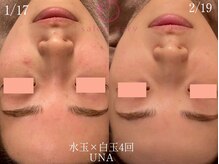 サロンヴェアリー 広尾(salon vary)/恵比寿広尾｜水玉テクスパ
