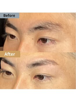 眉毛ハウス 吉祥寺店(眉毛HOUSE)/お客様の施術例(吉祥寺/東京)