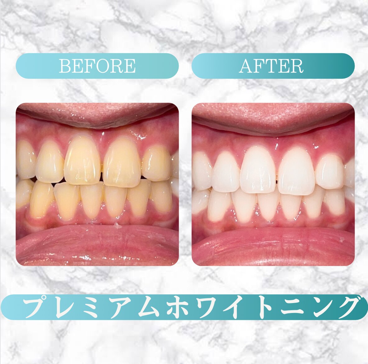 プラチナムホワイトニング GEL 40g 3個セット 【公式通販】