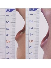 ランドル(rendre)/３０代女性　開口すると顎が痛い