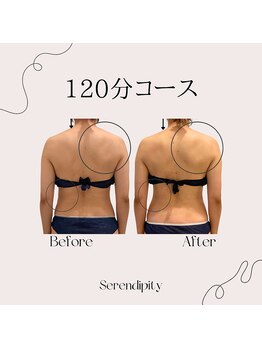 セレンディピティー(Serendipity)/姿勢、首肩こり改善/見た目痩せ