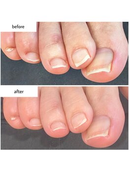 ケアプラス(care plus)/フットネイルケア