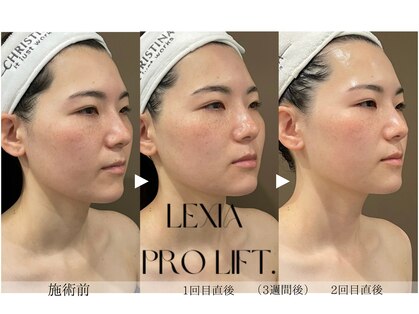 レクシア(LEXIA)の写真