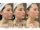 レクシア(LEXIA)の写真