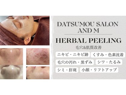 アンドエム(&M)の写真