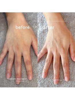 ゼロハチイチ(081)/Hand Spa Treatment