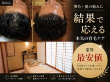 箔屋～hakuya～【育毛促進×幹細胞】