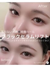 レシェリマ(Lesherima)/ブラックセラムリフト