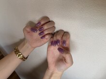 バイオ ナゴヤ(Bio nagoya)/フィルイン・パラジェル変更可