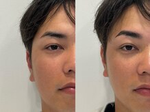 クラッシーブロウ 浦添/メンズ眉毛パーマ(HBL)