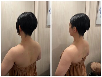 ハリーナ(HARI-NA)/首肩こり改善して姿勢もスッキリ