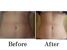 ヨサパーク リナ(YOSA PARK Rina)