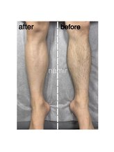 脱毛サロンnamir札幌店【ブラジリアンワックス/美容脱毛/眉毛】～メンズ/レディース～/men's【足全体ワックス脱毛】