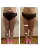 ヨサパーク アミカル 八幡山店(YOSAPARK amical)/最先端よもぎ蒸し一度で隙間が！