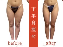 ウィズルーチェ 麻布十番店(with luce)/２０代　下半身　骨盤　　痩身