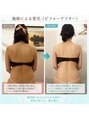 ケイビューティ(k-beauty) ◎ニキビ◎ブライダル/肩こり