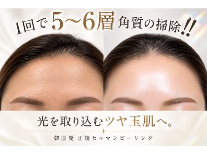 キューレット(CULET)の写真