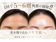 キューレット(CULET)の写真