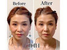 小顔22 ボルティ 本店(Bolty)/お客様