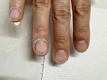 コティ(cotty)/ケアのススメ