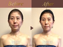 オーシャン(Ocean)/全身美容矯正120分/週1回×10回