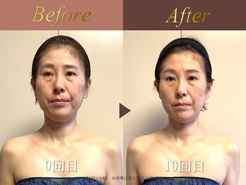 オーシャン(Ocean)/全身美容矯正120分/週1回×10回