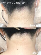 エムズスタイル ネイルバー(M's Style NAIL BAR)/うなじ脱毛