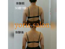 ヨリーズサロン 渡辺通(yoris.salon)の雰囲気（ミラクルバストで背中スッキリ★後ろ姿美人♪見た目年齢に変化）