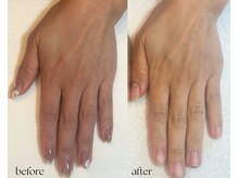 めぐり 南流山(meguri)/ハンドトリートメント10回パス